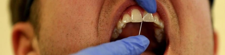 Benefits of flossing teeth regularly