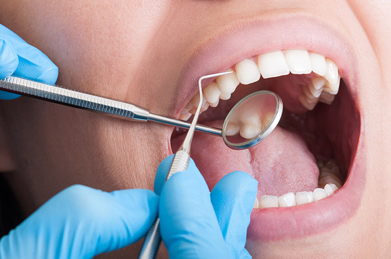 root canal therapy service in Fort Saskatchewan